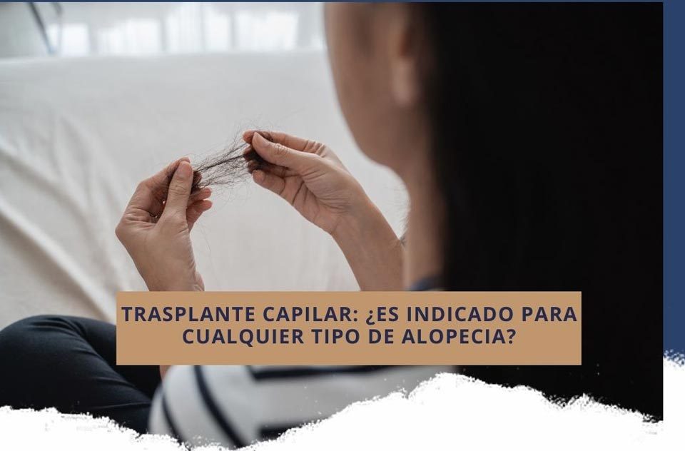 Trasplante capilar: ¿es indicado para cualquier tipo de alopecia?