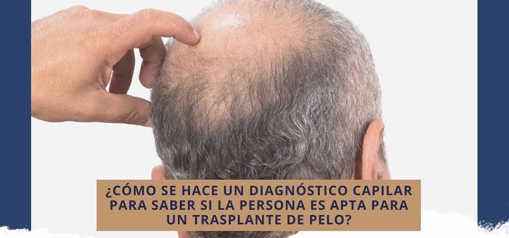 ¿Cómo se hace un diagnóstico capilar para saber si la persona es apta para un trasplante de pelo?
