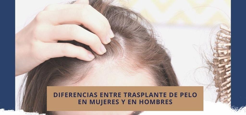 Diferencias entre trasplante de pelo en mujeres y en hombres