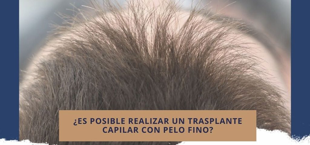 ¿Es posible realizar un trasplante capilar con pelo fino?