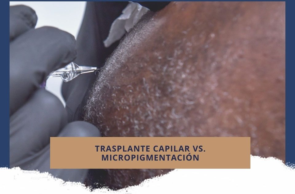 Trasplante capilar vs. Micropigmentación